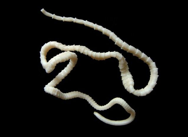 bovine tapeworms in the human body