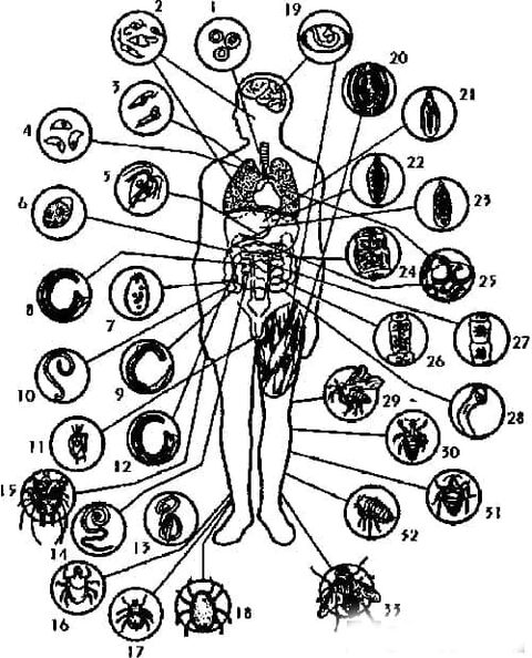The type of parasite