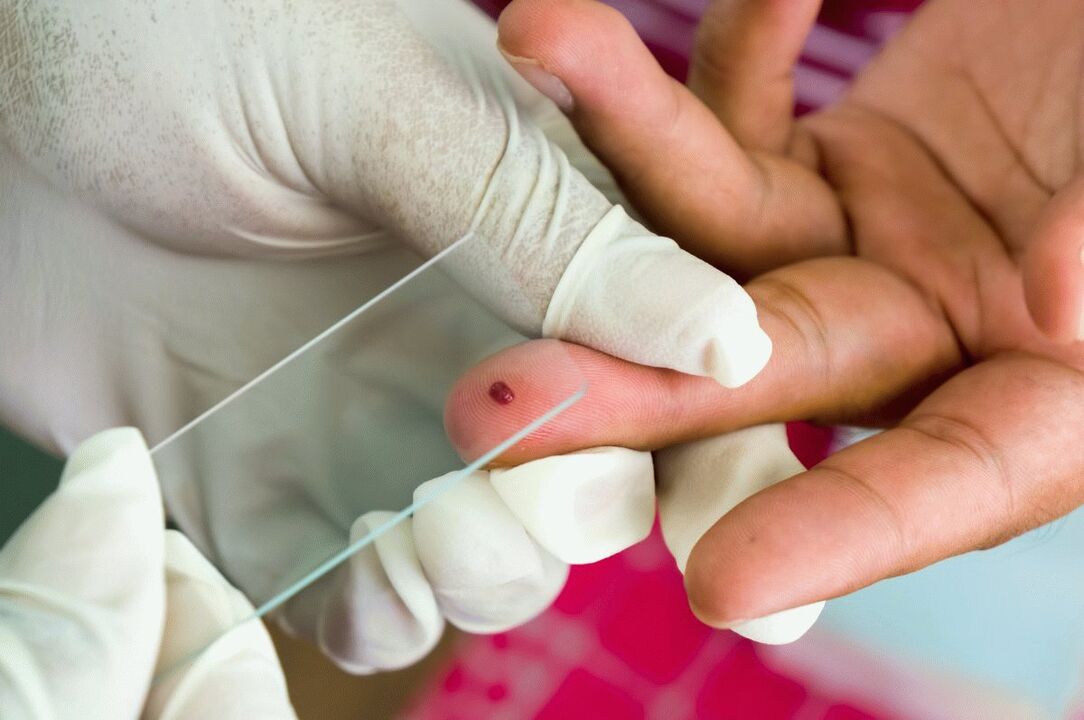 Blood tests from fingers