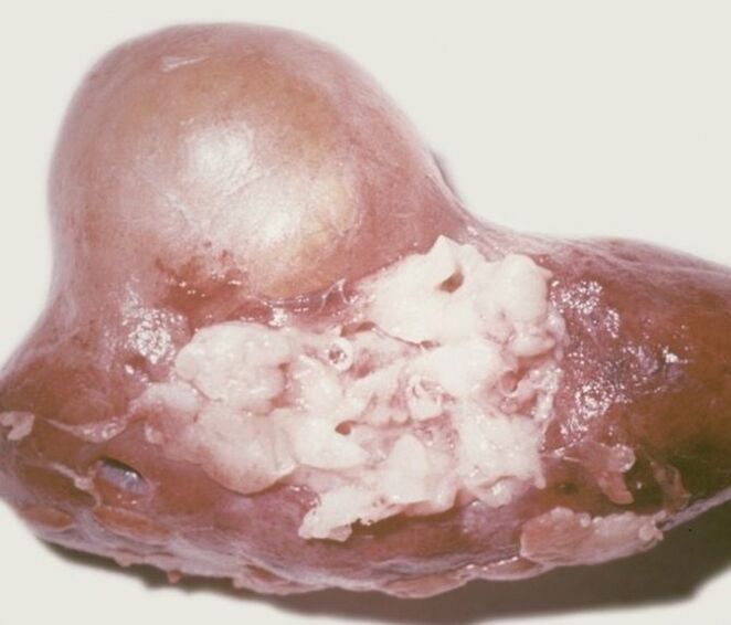 What is a parasite