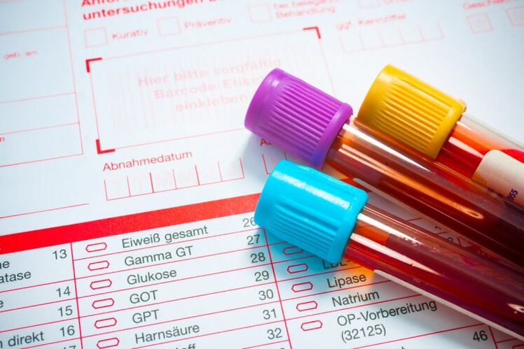 Blood for research on parasites