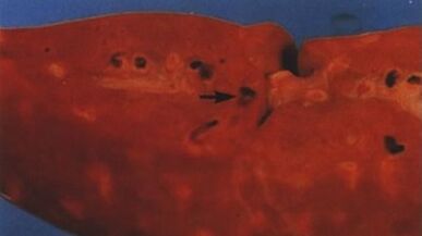 What parasites can live in the human heart