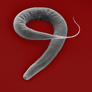 hookworm infection,